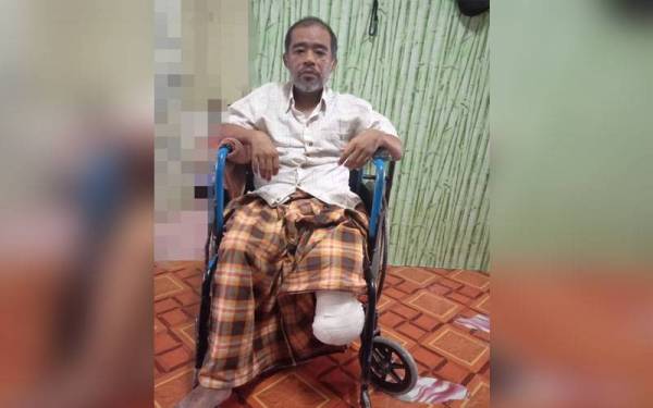 Sazali Ibrahim, 45, hilang sebelah kaki akibat penyakit kencing manis kronik.