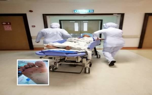 Luzman ditolak ke bilik bedah HSNZ Kuala Terengganu bagi proses mencabut duri landak laut yang dipijak ketika mandi-manda bersama lima ahli keluarganya di Pantai Tok Jembal, Kuala Nerus pada Rabu. Foto Ihsan keluarga