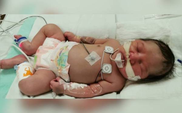 Muhammad Habiburrahman kini ditempatkan di NICU Hospital Pulau Pinang dan menggunakan peralatan bantuan pernafasan.