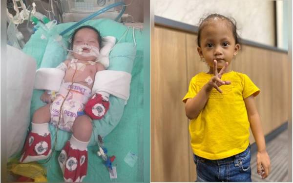 Nur Afia pada usia dua bulan telah menjalani dua pembedahan pada jantungnya.