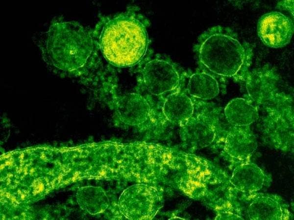 Singapura mengesan tiga lagi kes Covid-19 yang hasil ujian saringan awal mendapati positif varian Omicron.Gambar hiasan