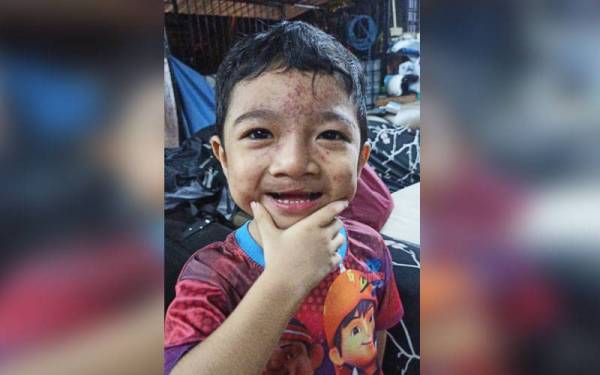 Keadaan Muhammad Aisy Aidan sebelum disahkan menghidap leukemia.
