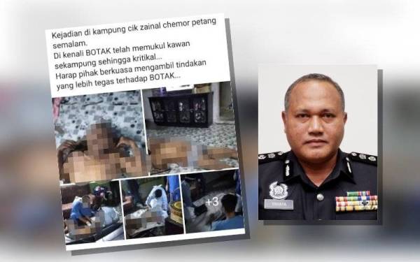 Tular lelaki yang cedera dipukul rakannya di Ipoh pada Selasa. - Foto pembaca (Asisten Komisioner Yahaya Hassan)