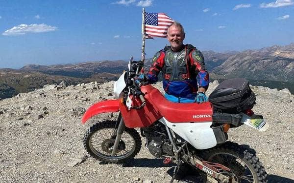 Jim Parsons menerima dua buah pinggang babi dalam satu pembedahan di sebuah hospital di Amerika Syarikat. - Foto Keluarga Parsons