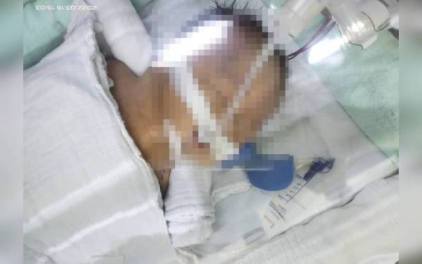 Muhammad Ariq Mikhail perlu menjalani pembedahan segera.