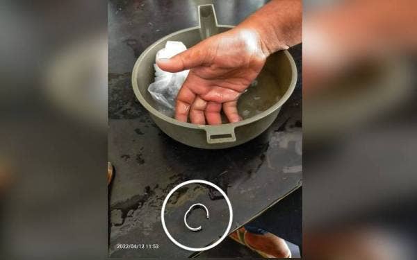 Cincin besi (dalam bulatan) yang berjaya dipotong bomba. - Foto: ihsan bomba