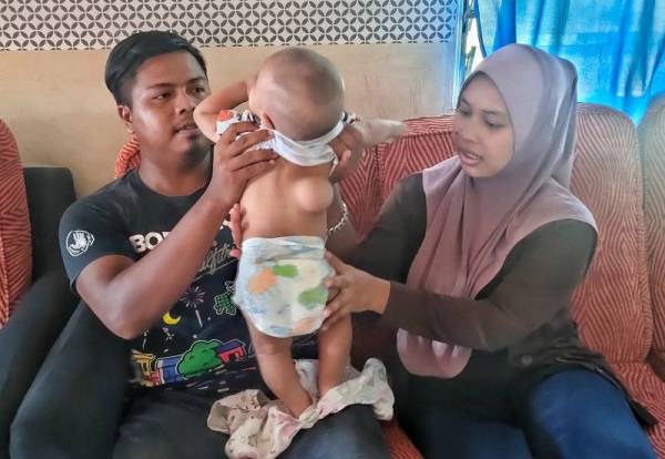 Mohammad Faizzudin (kiri) dan isterinya menunjukkan benjolan di bahagian belakang badan Faith Rizqi.