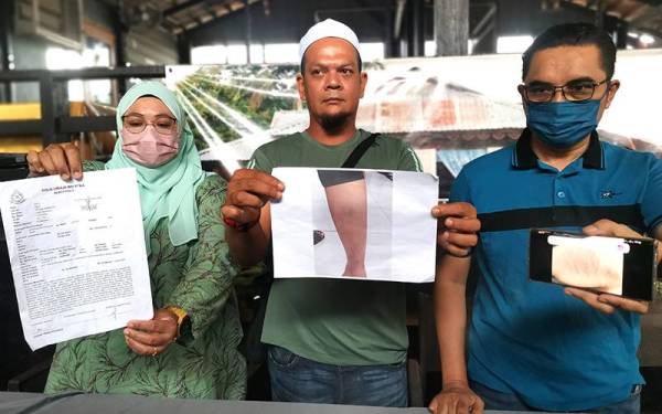 Noor Azmi (tengah) dan Ahmad Fauzi (kanan) menunjukkan laporan polis dan gambar kecederaan yang dialami anak mereka pada sidang akhbar di sebuah restoran di Seremban pada Isnin.