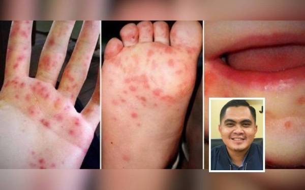 Gambar kecil: Dr Muhamad Akmal