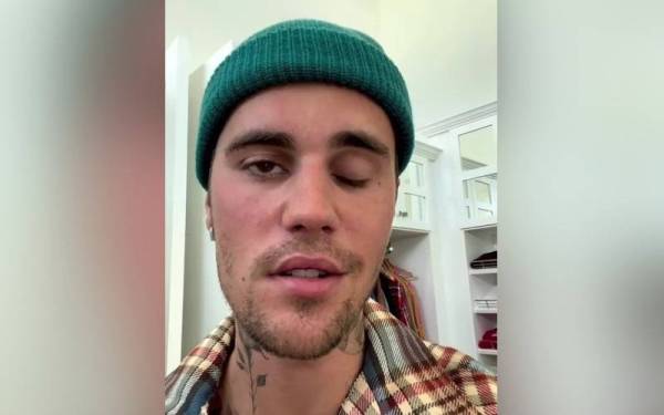 Bahagian kanan muka penyanyi Justin Bieber lumpuh akibat sindrom Ramsay Hunt. - Foto Justin Bieber/Instagram