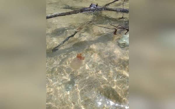 Ubur-ubur yang dipercayai menyebabkan mangsa mengalami gatal-gatal dan merah pada badan selepas terkena.- Foto Ihsan APM