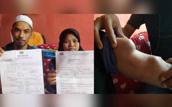 Adib dan Alia menunjukkan surat rujukan berhubung rawatan dan pembedahan di HKL hujung bulan ini. Adib menunjukkan bengkak di lengan Alia yang semakin membesar dan memerlukan rawatan serta pembedahan.