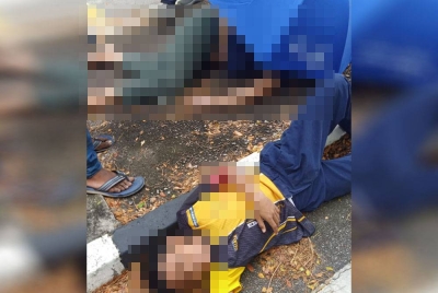 Mangsa cedera parah di bahagian kepala dan disahkan maut di tempat kejadian manakala rakannya cedera ringan.