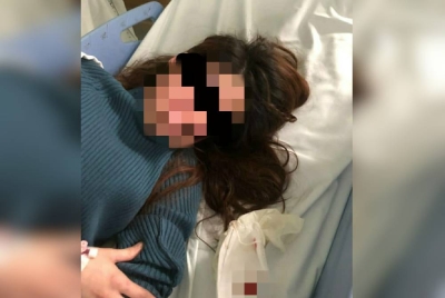 Mangsa mengalami kesan bengkak di muka dan pendarahan dalam kedua-dua belah mata.