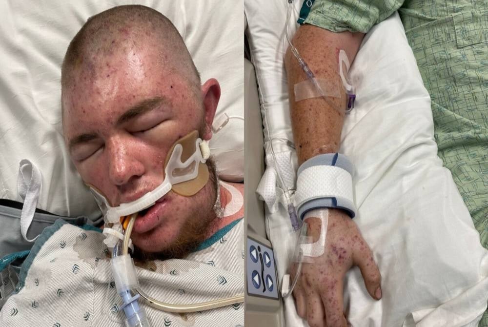 Bellamy yang dikomakan sejak Selasa lalu kini ditempatkan di Pusat Perubatan Universiti Cincinnati. - Foto Agensi