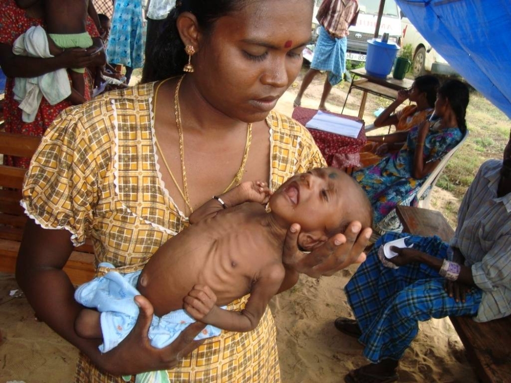 Krisis di Sri Lanka menyebabkan kanak-kanak turut mengalami kekurangan zat makanan - Agensi
