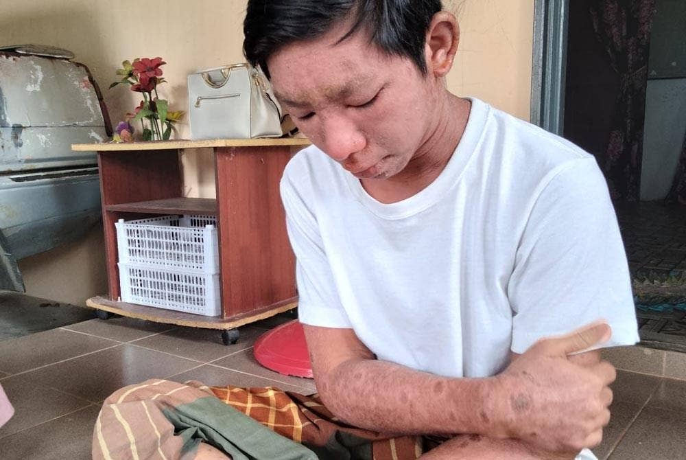 Tuan Mohamad Hanif berharap ada pihak yang sudi membantu bagi menyembuhkan penyakitnya.