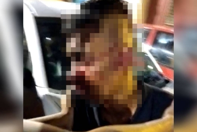 Polis menjalankan siasatan berhubung video tular memaparkan seorang lelaki parah dipukul dalam kejadian di Flat San Peng, Jalan Gandek, Pudu di sini pada Rabu.