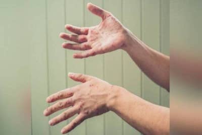 Gambar hiasan - Foto 123RF