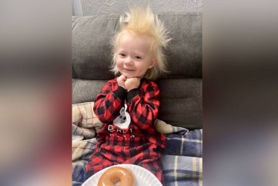 Aurora mengalami rambut 'pacak' sejak berusia setahun. - Foto Agensi