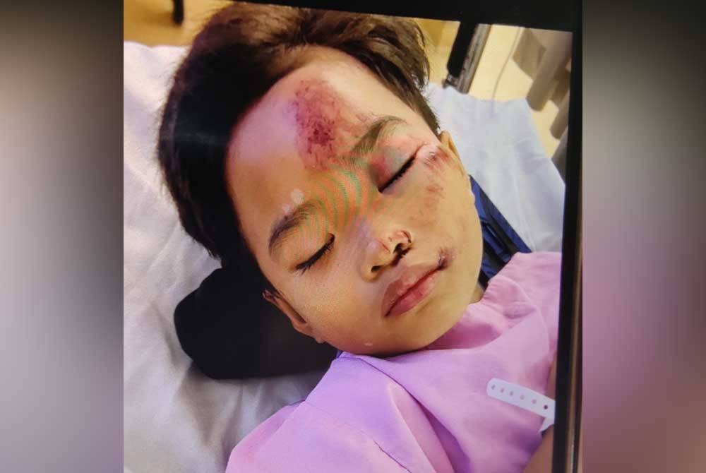 Keadaan Shahfaraz Aiefan yang mendapat rawatan di Hospital Shah Alam.