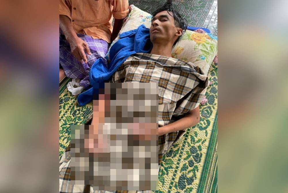 Norhisham terbaring dalam keadaan lemah dan mengalami calar pada badan. - Foto Bomba