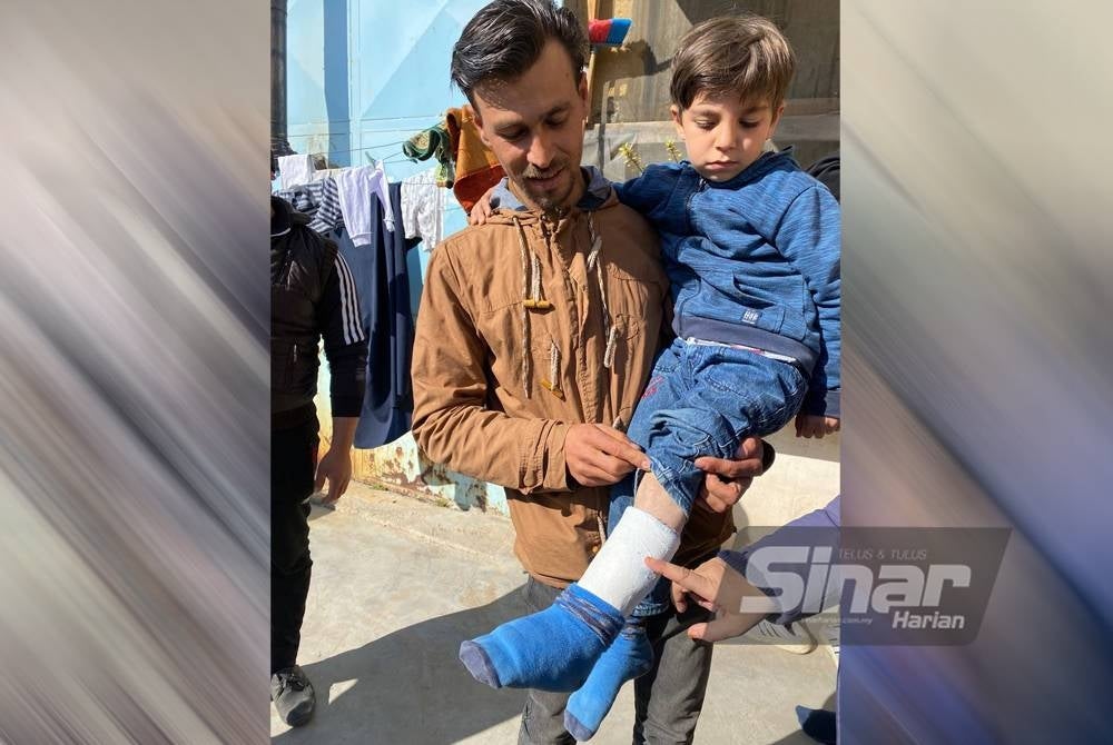 Iwadh Sattouf menunjukkan kaki kiri anaknya yang patah selepas dua beranak itu terjun dari bangunan kediaman mereka di tingkat dua sebelum rumah mereka di Antakya roboh.