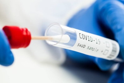 KKM merekodkan sebanyak 241 kes baharu Covid-19 pada Jumaat dengan satu daripadanya merupakan kes import. (Gambar hiasan) - Foto 123rf