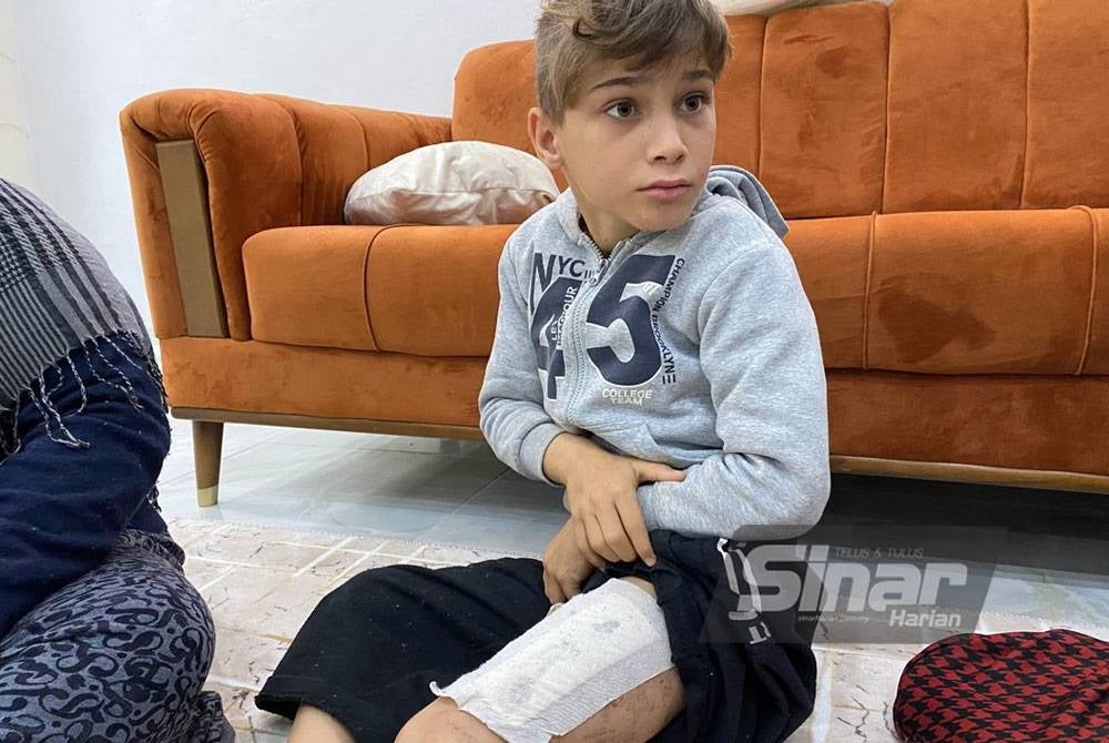 Omar Tayyar, 10, mengalami kecederaan di mana daging pahanya terkoyak ketika orang ramai menariknya keluar dari runtuhan bangunan kediamannya di Antakya.