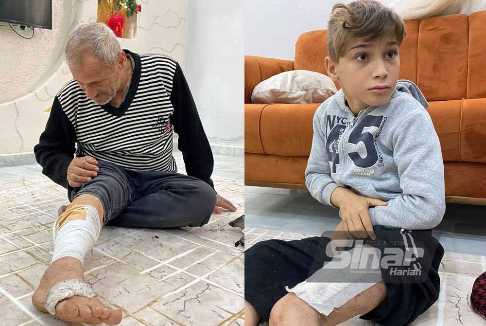 Fevas Tayyar mengalami kecederaan retak kaki kanan ditimpa dinding rumah ketika cubaanya menyelamatkan diri dalam kejadian gempa bumi di Turkiye pada 6 Februari lalu. Gambar kanan: Omar Tayyar, 10, mengalami kecederaan di pahanya.