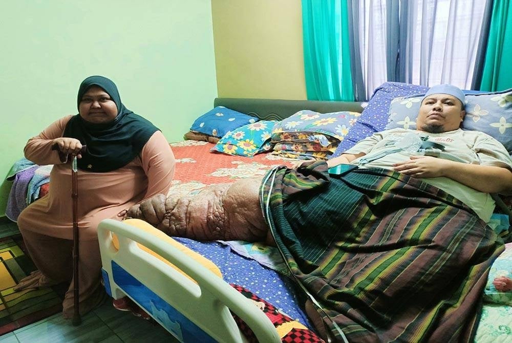 Shahrul Anuar dan isteri, Intanursyima berharap dapat mengumpul dana RM80,000 bagi menjalani pembedahan yang dijadualkan bulan depan.