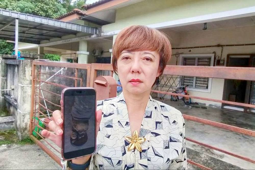 Nicole menunjukkan foto kaki Augustine.