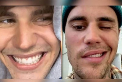 Bieber menunjukkan dia mampu mengerdipkan mata serta menggerakkan kening. - Foto Instagram/Justin Bieber