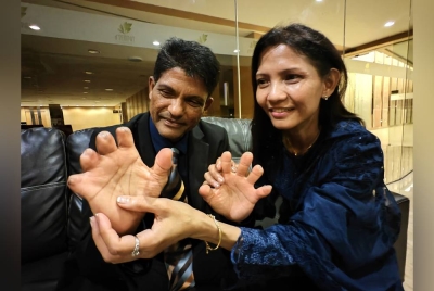 Leela memegang tangan Ravichandran yang kehilangan lapan jari selepas kali pertama mendaki Gunung Everest.