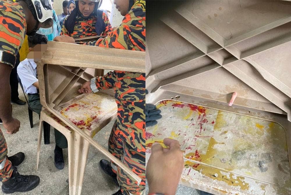 Anggota bomba menjalankan operasi mengeluarkan jari manis mangsa yang tersangkut pada lubang meja sekolah di Batu Gajah. (Gambar kanan: Jari manis pelajar berusia 14 tahun tersangkut pada lubang meja plastik dalam kejadian di salah sebuah sekolah menengah di Batu Gajah. Foto: Ihsan Bomba Perak)