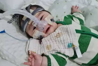 Wan Muhammad Naail Wan Aslam yang menghidap penyakit jarang jumpa, Spinal Muscular Athropy (SMA) Type 1.