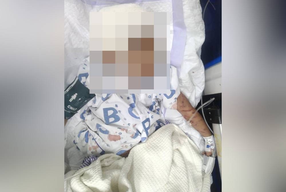 Kecederaan yang dialami kanak-kanak lelaki berusia empat tahun akibat diserang sekumpulan anjing dalam kejadian di Pitas.