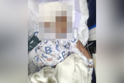 Kecederaan yang dialami kanak-kanak lelaki berusia empat tahun akibat diserang sekumpulan anjing dalam kejadian di Pitas.