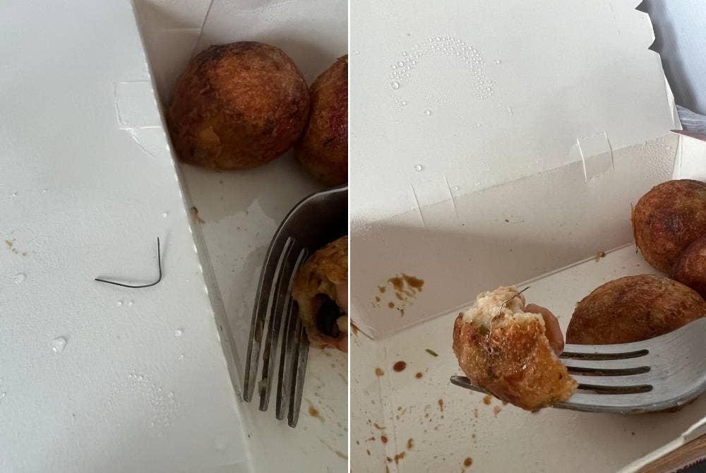 Seorang wanita hampir tercekik dawai berukuran 3cm yang terdapat dalam Takoyaki. - Foto Facebook Michelle Wong