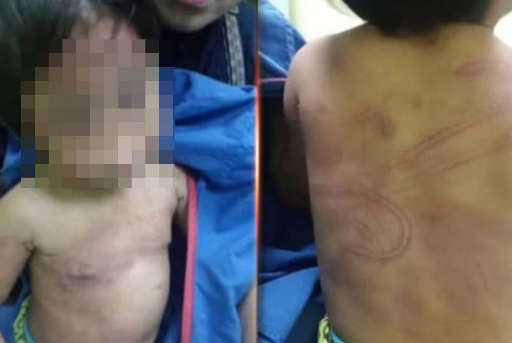 Kanak-kanak yang dipercayai didera oleh ibunya dan kekasih wanita itu menggunakan tangan dan penyangkut baju.