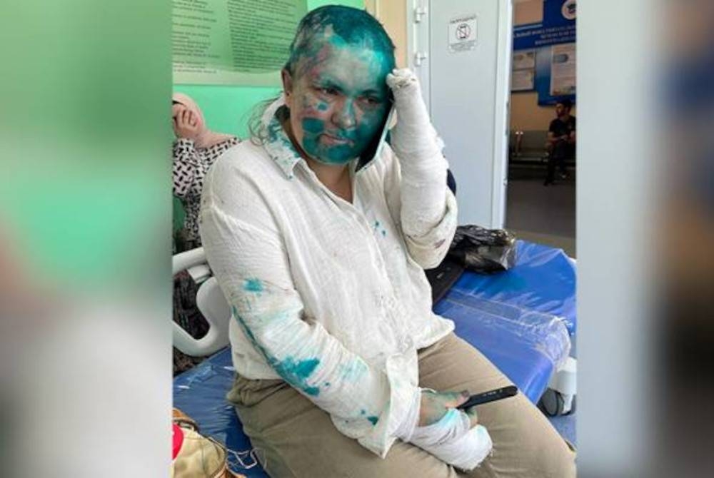 Wartawan Elena Milashina yang dibelasah sekumpulan penjenayah menerima rawatan di sebuah hospital di Grozny, Chechen. - Foto AP