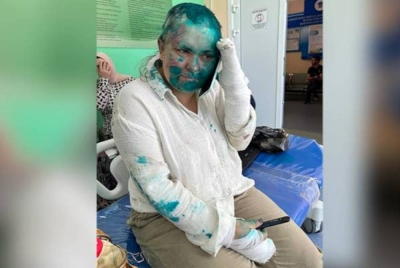 Wartawan Elena Milashina yang dibelasah sekumpulan penjenayah menerima rawatan di sebuah hospital di Grozny, Chechen. - Foto AP