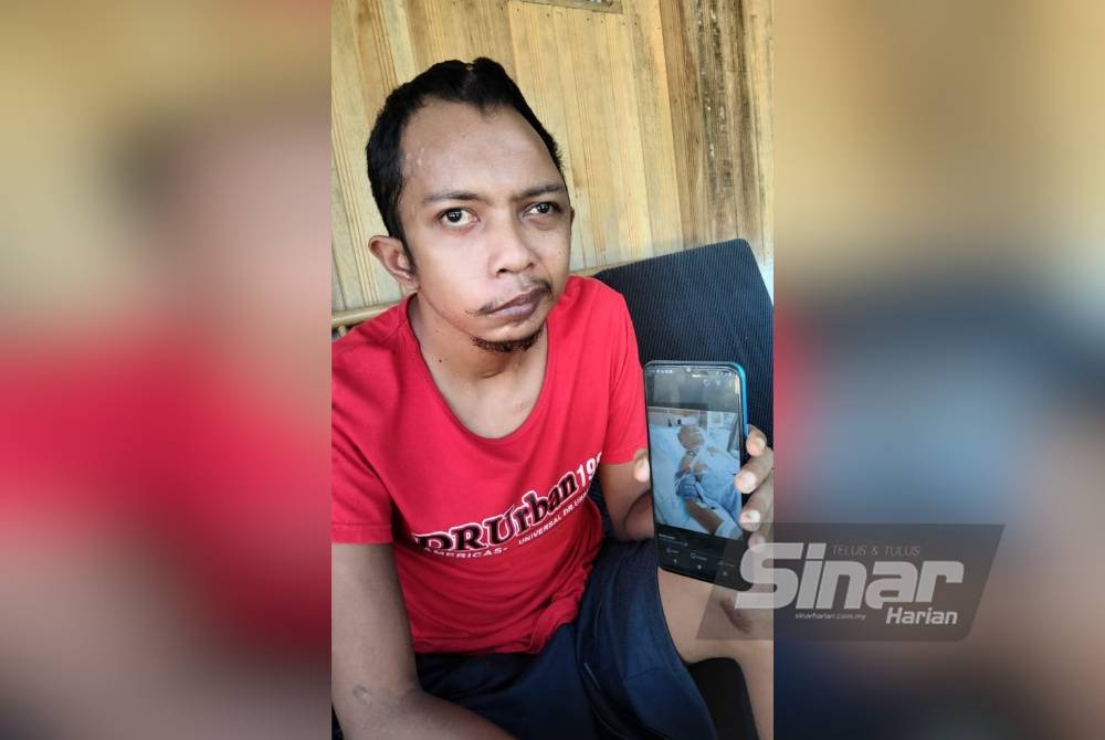 Muhammad Azwan Zani menunjukkan gambarnya ketika koma dan menjalani rawatan di HUSM, Kubang Kerian.