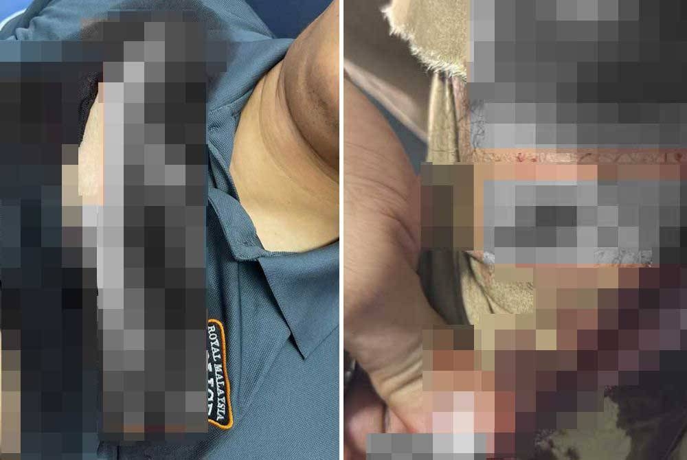 Seorang anggota Bahagian Siasatan Jenayah IPD Kulim menerima lima jahitan di kaki ketika cuba menahan suspek kes curi di Kulim.