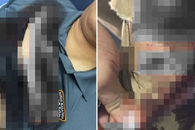 Seorang anggota Bahagian Siasatan Jenayah IPD Kulim menerima lima jahitan di kaki ketika cuba menahan suspek kes curi di Kulim.