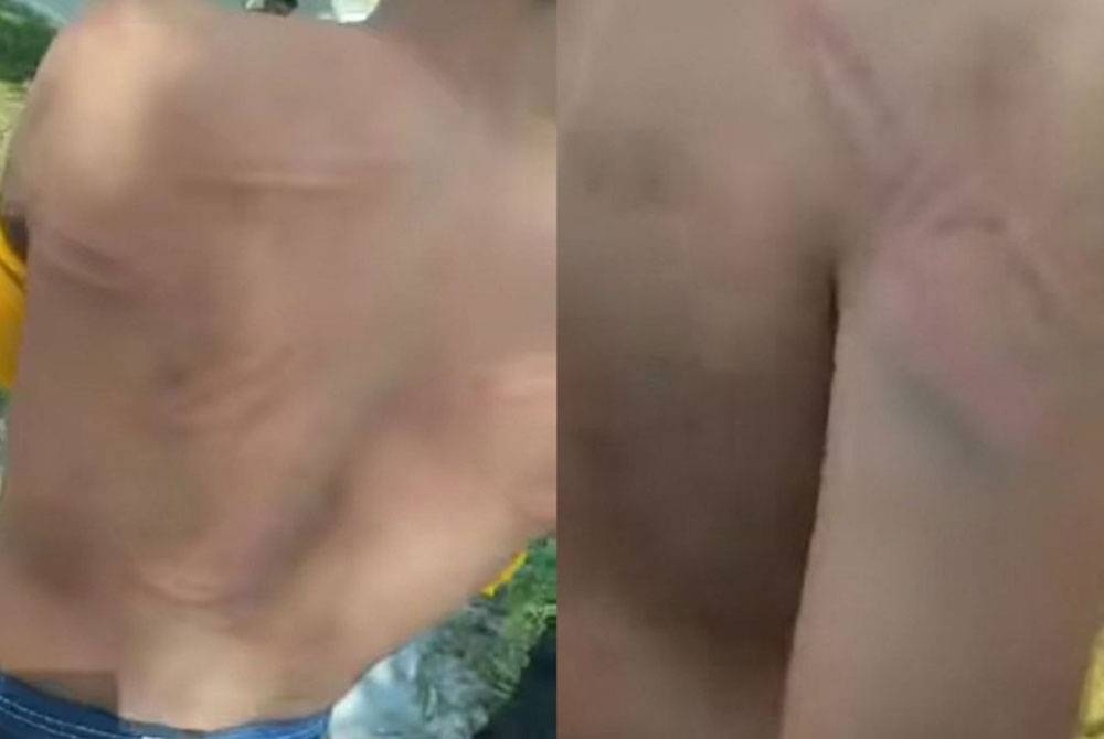 Kesan pada tubuh mangsa dipercayai dipukul dengan cota.