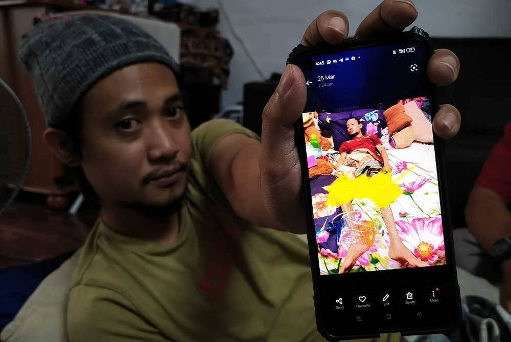 Mohammad Asma'an menunjukkan keadaan dirinya selepas disahkan menghidap kanser limfoma.