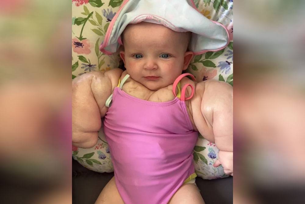 Armani yang dilahir dengan lengan dan dada besar seperti atlet bina badan. - Agensi