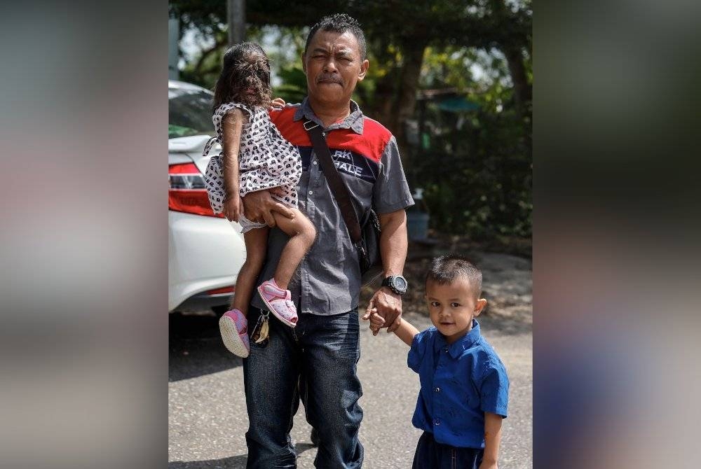 Roland Jimbai, 48, bersama Missclyen Roland, dua tahun, yang dilahirkan dengan wajah dan tubuh berbulu lebat akibat sindrom congenital generalised hypertrichosis (CGH), ketika ditemui di Kampung Penan Muslim Batu 10, Bintulu- Miri. - Foto Bernama