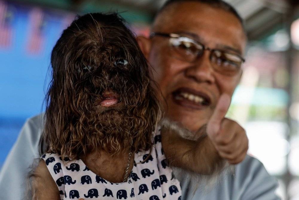 Missclyen, 2, dikenal pasti menghidap sindrom Congenital Generalised Hypertrichosis. - Foto Berna